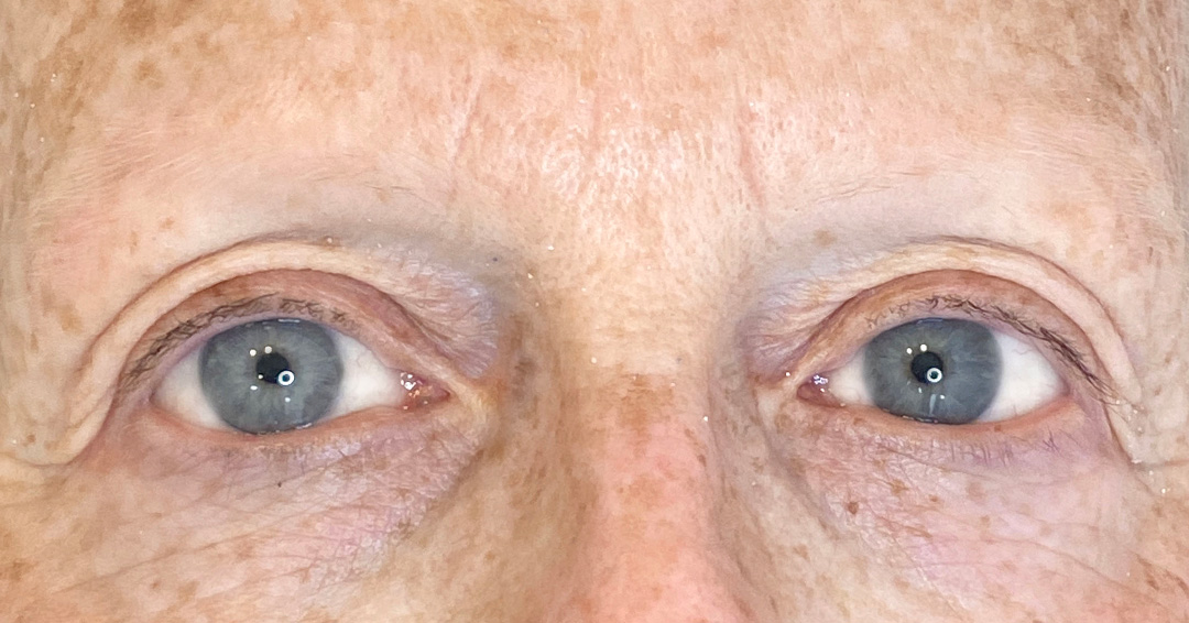 Micropigmentation For Women Over 60 Years Of Age