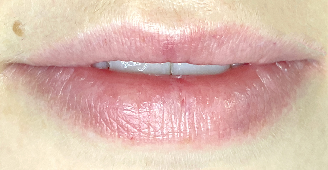 1-mejorar-color-labios-2