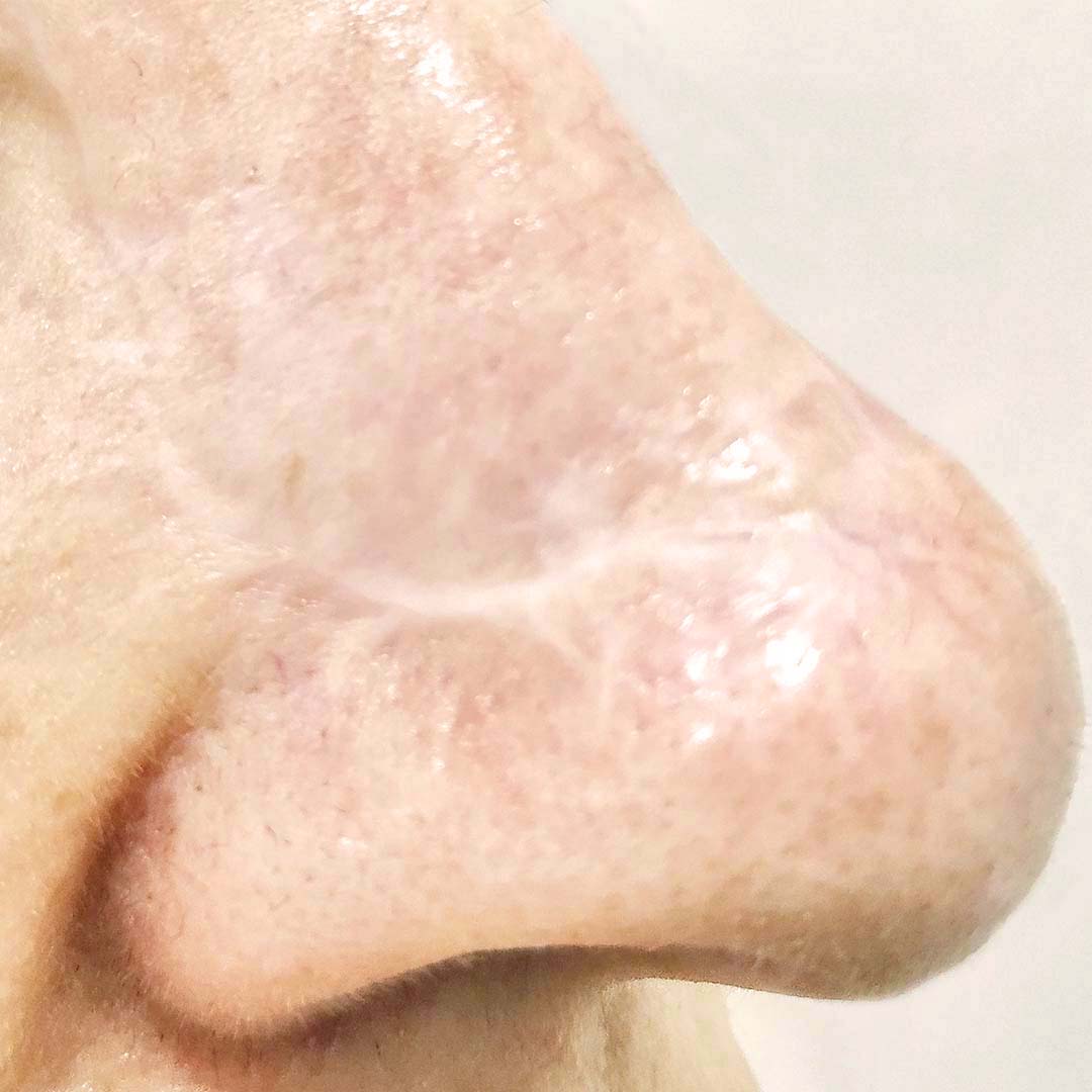 camuflage-cicatrices-faciales.jpg camuflage-cicatrices-faciales.jpg