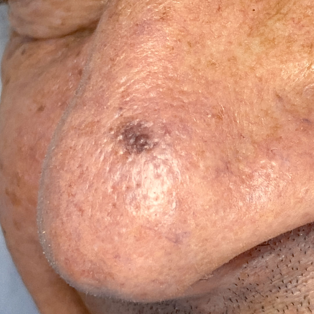 tratamiento-para-manchas-faciales.jpg tratamiento-para-manchas-faciales.jpg