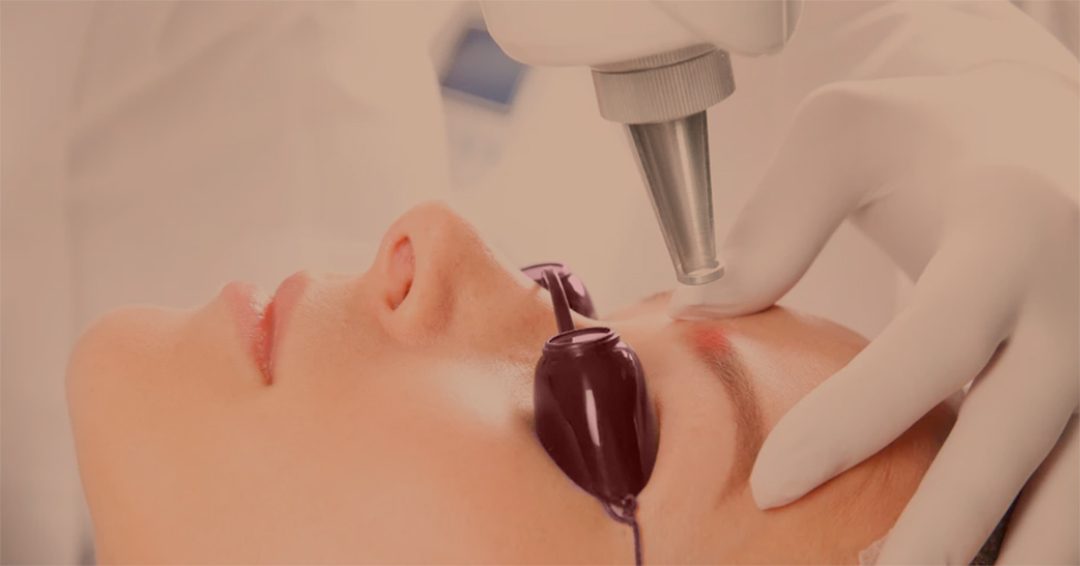 la-micropigmentacion-si-es-reversible-mediante-laser